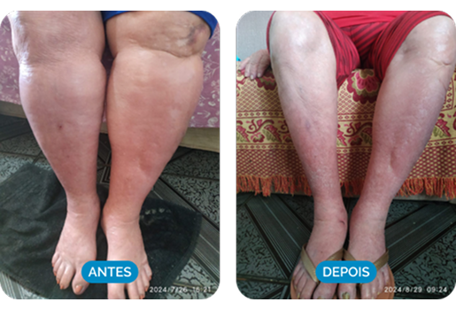 Testimonial Result