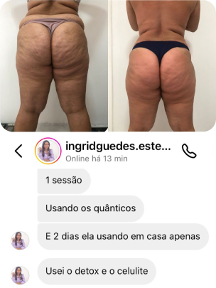 Resultado do tratamento