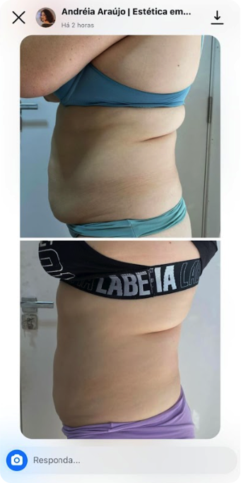 Depoimento 2