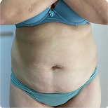 Depoimento de cliente 1