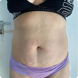 Depoimento de cliente 2