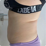 Depoimento de cliente 4